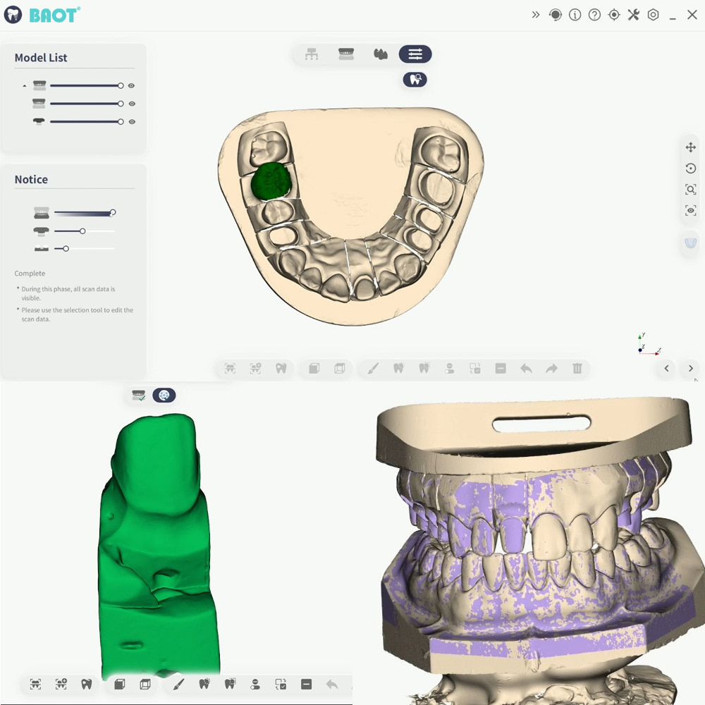 Dental 3D Scanner Machine Lower Jaw Scan