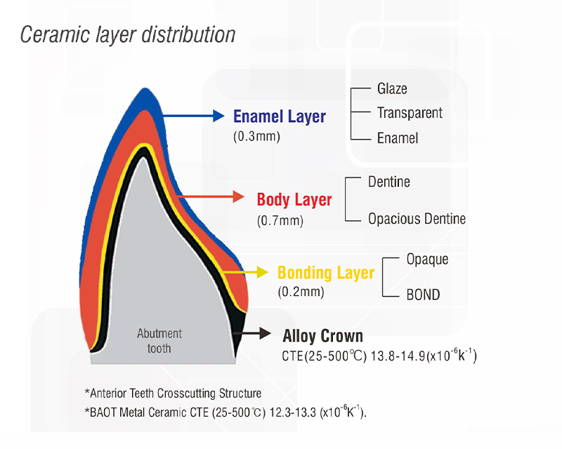 Dental Porcelain Powder for Ceramics layer Dental Porcelain Powder for Ceramics layer